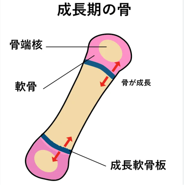 骨端核　シェーマ